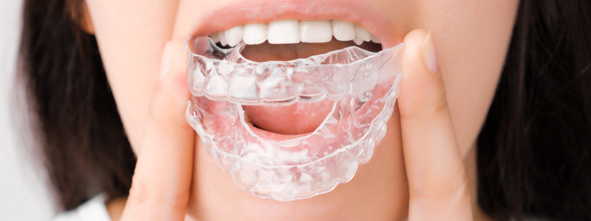 Invisalign tedavisi ağrılı mıdır, ilk günlerde baskı hissi normal midir?