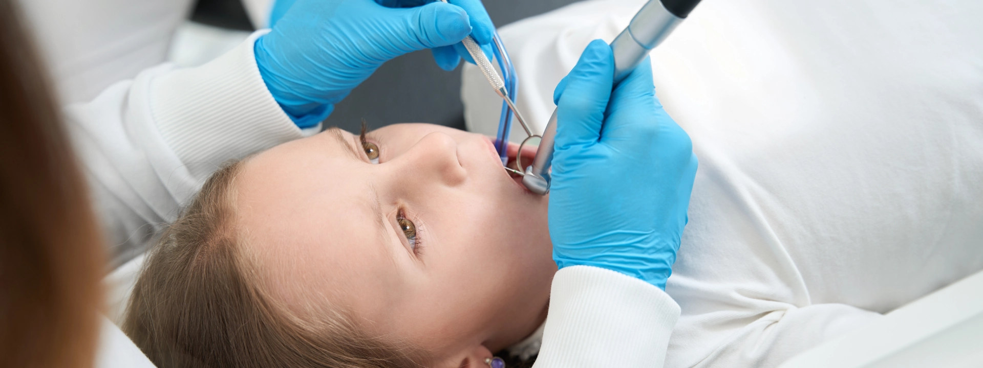 Fissür Örtücü Kaç Yaşında Yapılır?