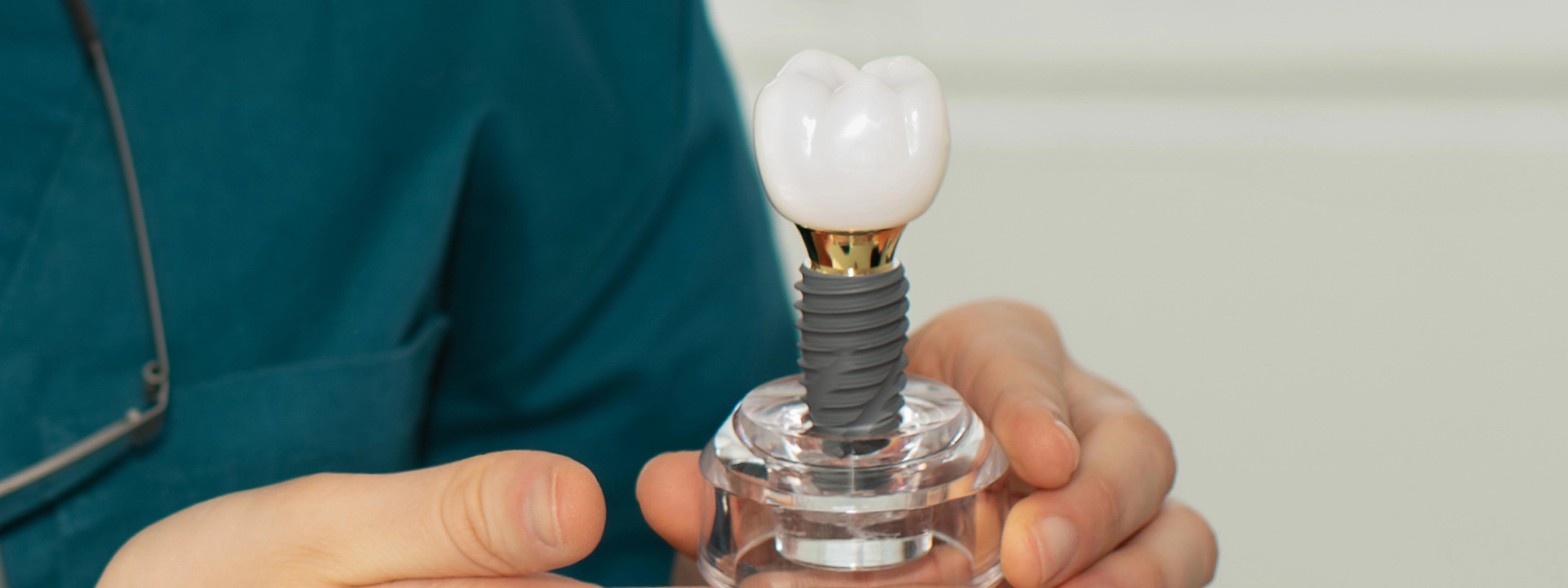 İmplant Ömrü Ne Kadar? Kaç Yıl Kullanılabilir?